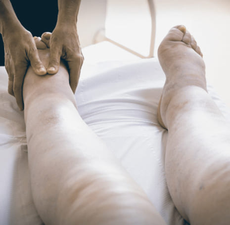 Tratamiento de linfedema en la Roma